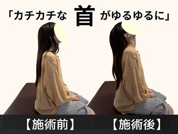 パルマ なかもず(Palma)/首が動くようになる！