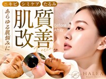 ハレア(HALEA)