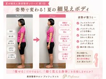 プレフェランス(Preference)の雰囲気（老化・たるみストップ！輪郭キレイな小顔美人作りが得意です◎）