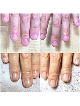 ジェルで自爪育成