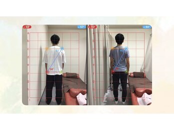 船橋はりきゅう整骨院/鍼/肩こり/腰痛/整体/マッサージ