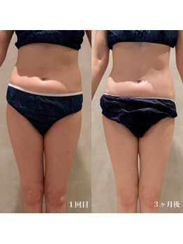 パウ(Paw)/変化写真