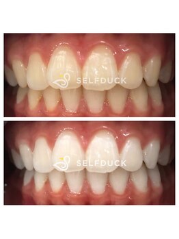 セルフダック 赤坂店(SELFDUCK)/