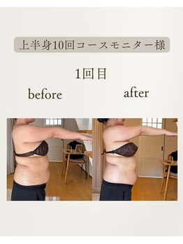 きぃ オリジンプラス(きぃ origin+)/上半身before after