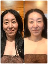 ハピネスエグゼ/１２０分1度のビフォーアフター