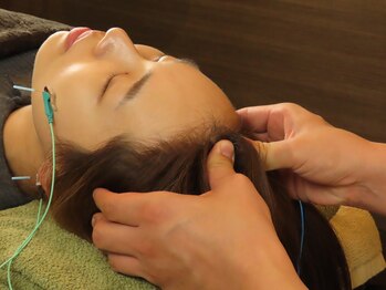 平岸ジュド整体院 整骨院(Judo)/美容鍼【肌質改善・トーンUP】