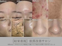 ヴィヴ フォー アール(VIV for R)