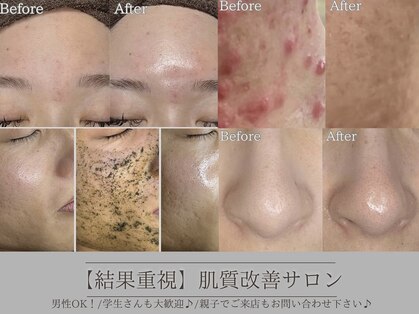 ヴィヴ フォー アール(VIV for R)の写真