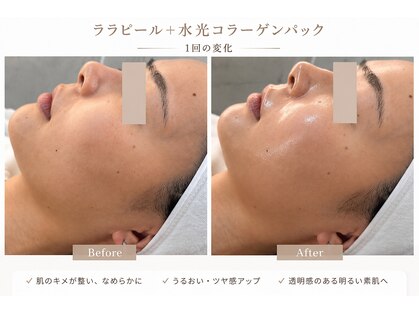 エクロール リ スキン(Eclore_re:skin)の写真