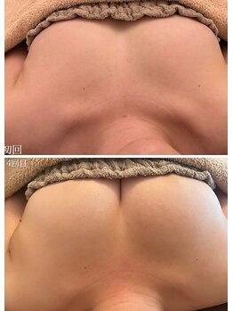 美人バスト 岡崎店/【バストアップ★育乳】症例