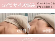 ラポッシュ(La poche)の雰囲気（バストアップ/バストケア/左右差/離れ乳/下垂/ハリ/広島/妊活）