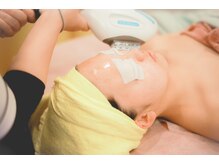 ビーフリー(Be Free)/顔脱毛