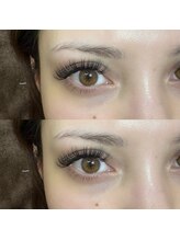 バニーアイズ 博多店(Bunny eyes)/バインドロック１４０束