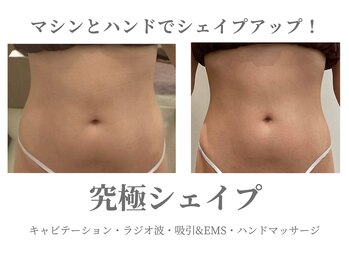 エクラ イオンモール徳島店(ECLAT)/究極シェイプ