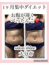 サロンシャイン(Salon Shine)/1か月集中ダイエット結果