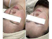 メイス 福井店(MEIS)/お客様Before、After