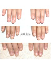 ネイル イコウ(nail ikou)/◇爪を育てる◇