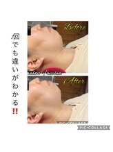 フリージア(Beauty Salon Freesia )/小顔リフトアップ