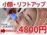 【ダウンタイム無し！リフトアップ】顔のたるみ改善して理想の小顔に♪4800円