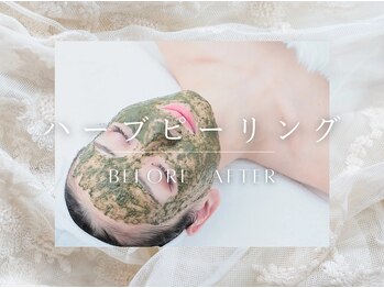 アンパウマン(Anpawman)/REVIハーブピーリング【にきび】