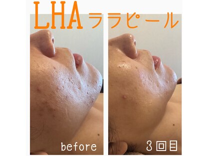 グレイティア(gratia)の写真