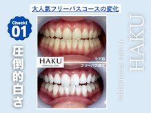 ハク 袋井磐田店(HAKU)/お客様before→after 1