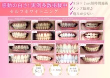 エクシアホワイトニング 盛岡中央通店