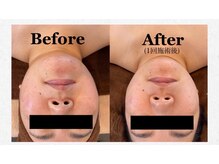 ベリンダ(BELINDA)の雰囲気（むくみケアのできるアキュライズ♪）