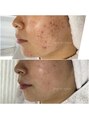ビューティーホリック 蘇我店(BEAUTY HOLIC)&nbsp;プログラム体験のお客様