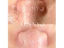 サロンリエム(Salon Riem.)の雰囲気（温泉成分配合セラムで美肌育成しながら毛穴のお悩みの解消！！）