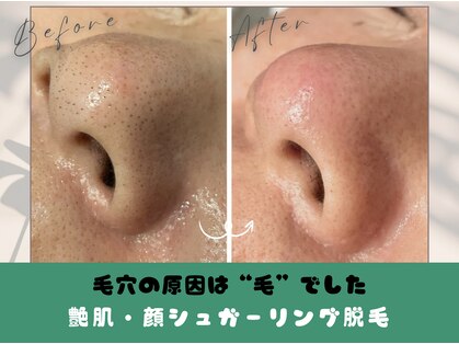 ルミニューズ(Luminuse)の写真