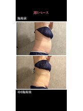 トータルビューティー ミミ(Total Beauty mimi)/美クビレをGETしよう♪