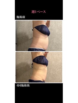 トータルビューティー ミミ(Total Beauty mimi)/美クビレをGETしよう♪