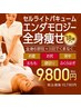 【医療提携痩身】大幅減量☆全身エンダモロジーコース