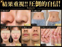 Recherche【ルシェルシェ】脱毛/痩身/小顔/肌質改善/くびれ/毛穴洗浄/メンズ/ネイル