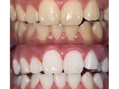 ホワイトニングビューティー 光の森店(WHITENING BEAUTY)の写真