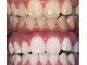 ホワイトニングビューティー 光の森店(WHITENING BEAUTY)の写真