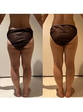 エムクオリティ(M-Quality)/全身痩身エステ