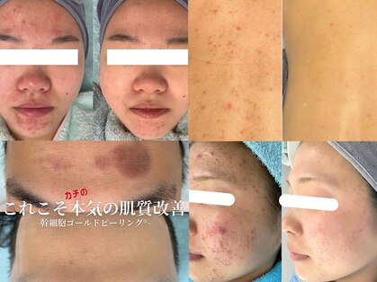 リメイクビューティークリニック(REMAKE BEAUTY CLINIC)の写真