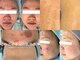 リメイクビューティークリニック(REMAKE BEAUTY CLINIC)の写真