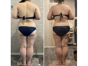 ハレアンド(Hare&)/ブライダル1ヶ所10回目