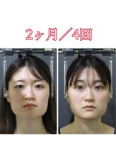 顔と身体の歪み矯正院 吉祥寺/ビフォーアフター