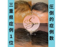 スリール(sourire)/三重県プロセル改善症例数No1