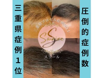スリール(sourire)/三重県プロセル改善症例数No1