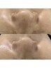 【毛穴レス卵肌♪】白玉WAX&KIWAMI毛穴洗浄 ￥12980！！！