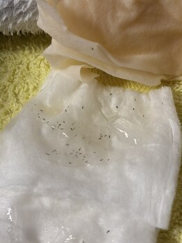 ファスモ(FASMO)/ここまで抜ける脱毛