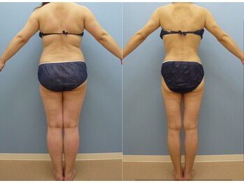 エピア 西尾店(Epia)/★コンテストでグランプリ受賞★