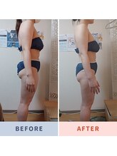 プライベートエステ カモミール/ハイパーマジック全身痩身120