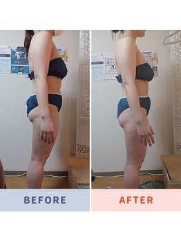 プライベートエステ カモミール/ハイパーマジック全身痩身120