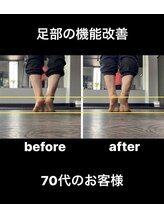 ドリップ 辻井店(DRiP)/ふくらはぎ細く｜むくみ改善実績